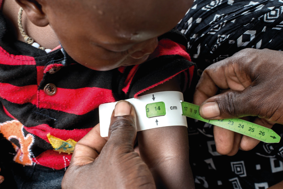 Medir la circunferencia del brazo de un niño es uno de los métodos para detectar la desnutrición. Foto: @BrunoDemeocq/Unicef Medir la circunferencia del brazo de un niño es uno de los métodos para detectar la desnutrición. Foto: @BrunoDemeocq/Unicef